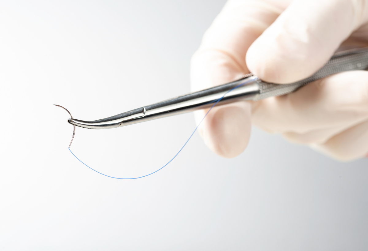 Laser Assisted Manufacturing of Barbed Sutures