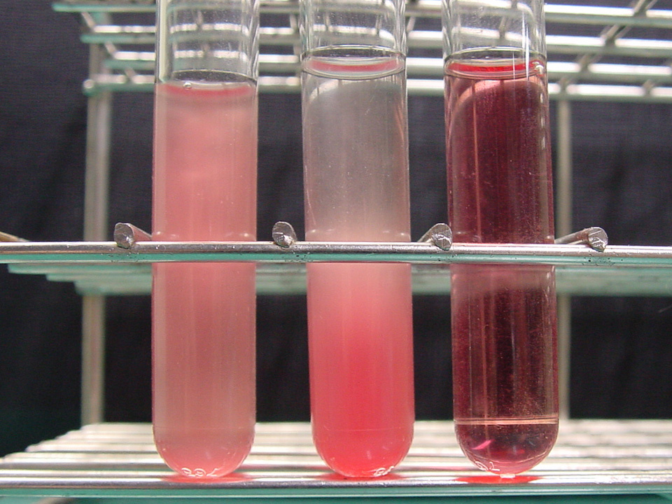 Hemove - Removing Hemoglobin from Hemolyzed Blood Samples