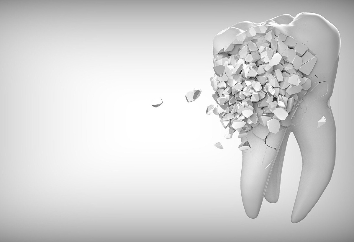 Next generation periodontal probe
