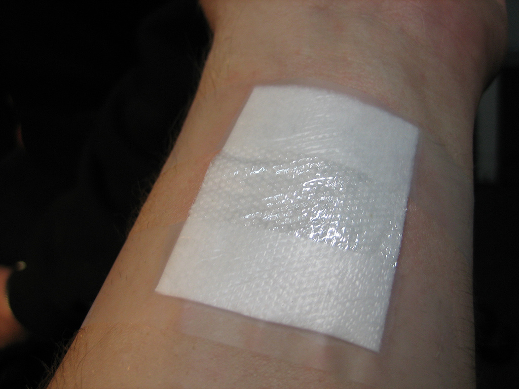 Smart Electroceutical Bandage