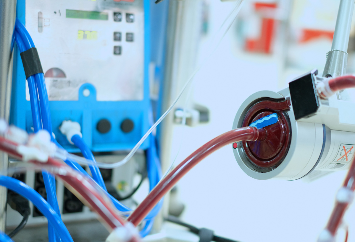 Miniaturised Integrated Ultra Portable Perfusion System