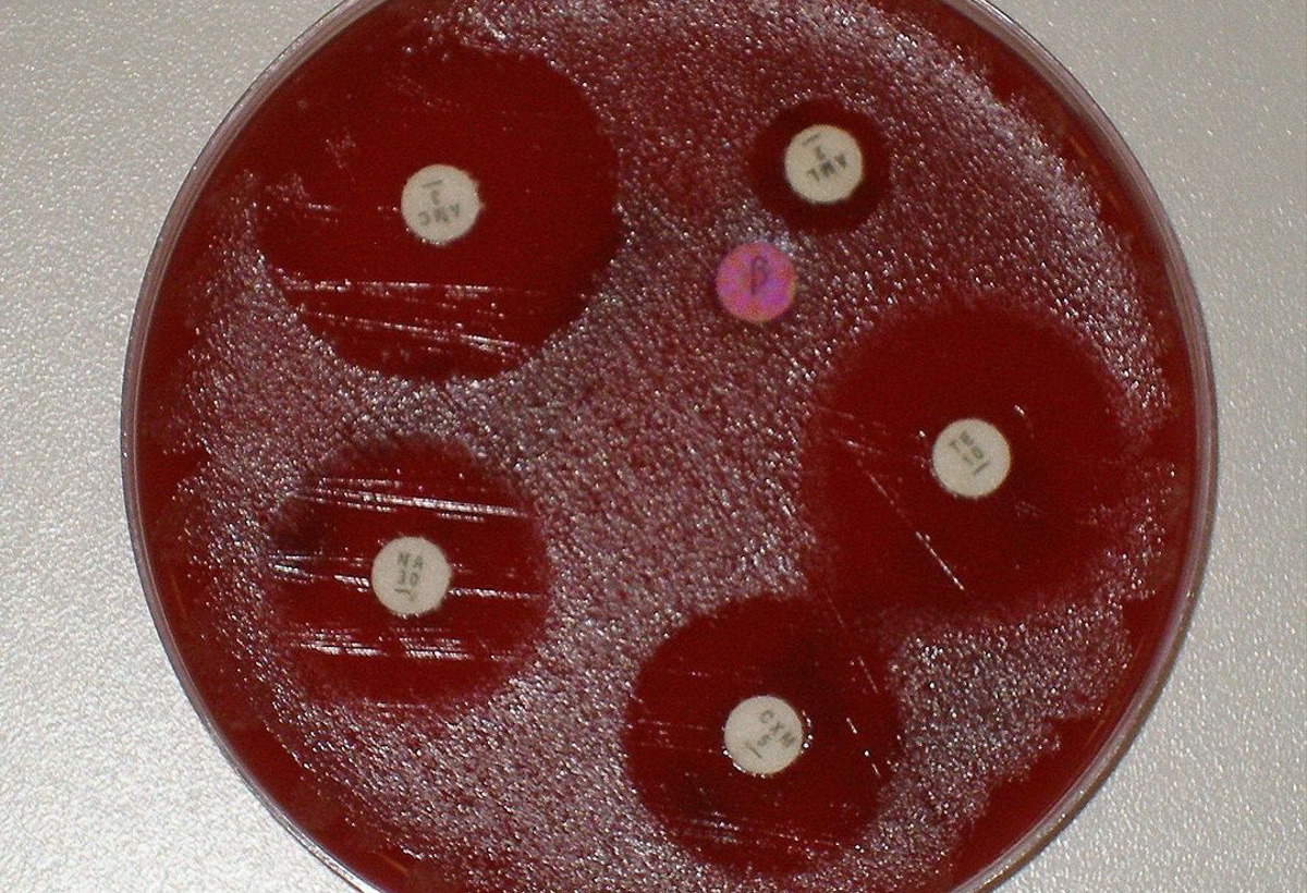 Novel Membrane Targeting Anti-microbials