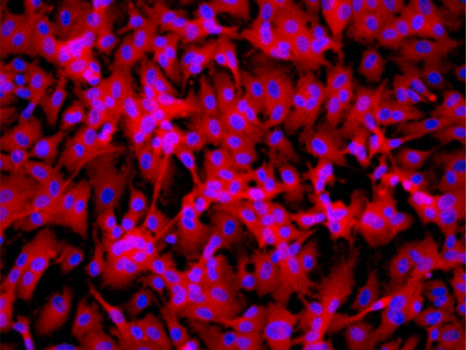 Cellular Models of Neurodegenerative Disease Derived from Human Cells