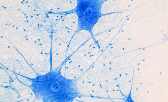Midbrain‐Microglia Assembloids