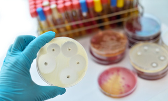 S-MGBs for Antibacterials
